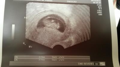 Bild zu Ich hab das Bild vergessen vor lauter Aufregung :) - Forum für Mai - Mamis
