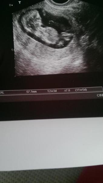 Bild zu Baby TV - Forum für Mai - Mamis