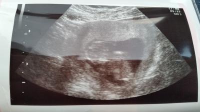 Bild zu War beim gyn - Forum für Mai - Mamis