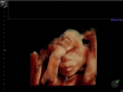 Bild zu Zurück vom Organscreening mit 3d Bild - Forum für Mai - Mamis