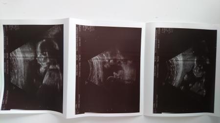 Bild zu Zweiter großer Ultraschall - Forum für Mai - Mamis