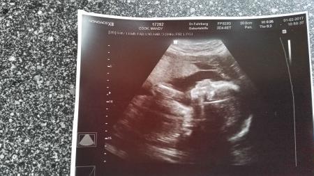 Bild zu 25SSW bald rum :-) - Forum für Mai - Mamis