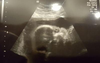 Bild zu War beim fa - Forum für Mai - Mamis