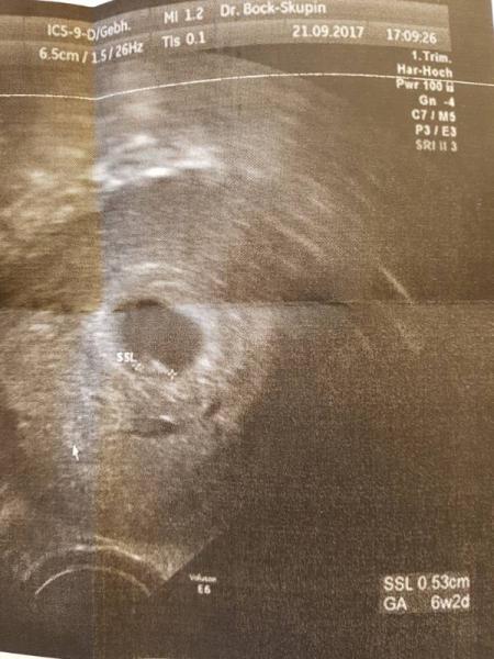Bild zu Muss euch was erzählen... - Forum für Mai - Mamis