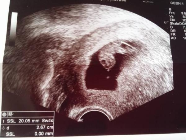 Bild zu Fa Termin - Forum für Mai - Mamis