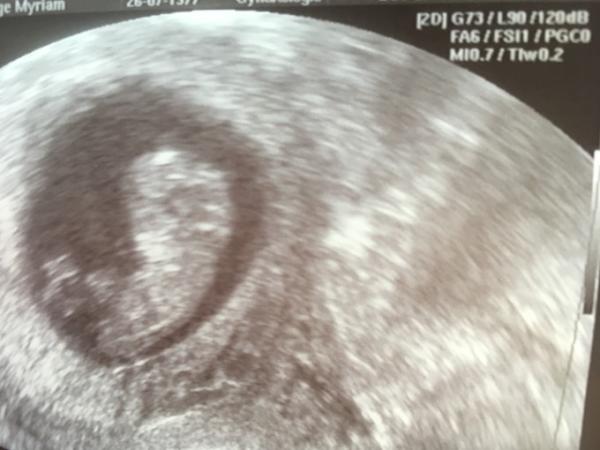 Bild zu 4 cm pures Glück  - Forum für Mai - Mamis