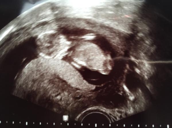 Bild zu Hallo 13. Woche... - Forum für Mai - Mamis