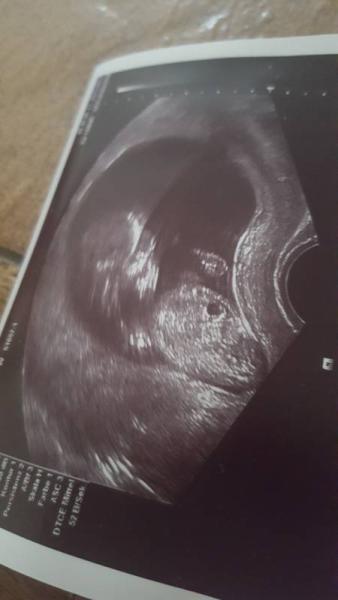 Bild zu neues Update - Forum für Mai - Mamis