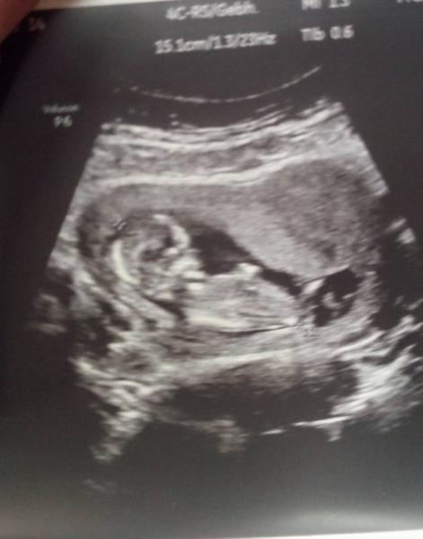 Bild zu Mein kleiner Hüpfer :) - Forum für Mai - Mamis