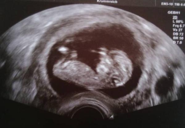 Bild zu Heute ersten großen Ultraschall gehabt - Forum für Mai - Mamis