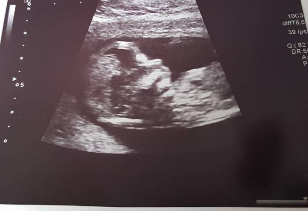 Bild zu Ersttrimester screening überstanden.. - Forum für Mai - Mamis