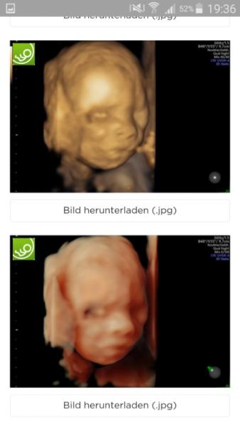 Bild zu feindiaknostik auch wir sind da gewese. - Forum für Mai - Mamis