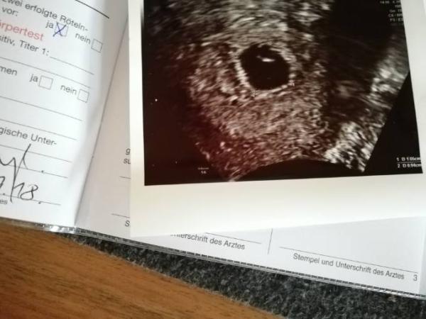 Bild zu 1. Ultraschall: Check - Forum für Mai - Mamis