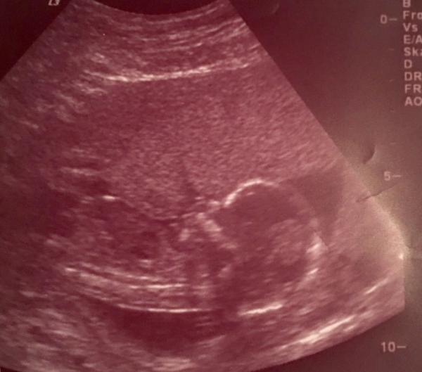 Bild zu Geschlecht 15+1 ssw - Forum für Mai - Mamis