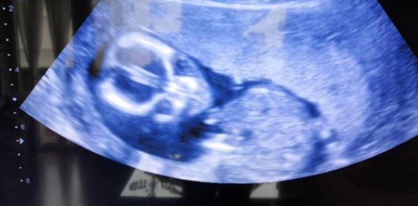 Bild zu Heute wieder Ultraschall gehabt - Forum für Mai - Mamis