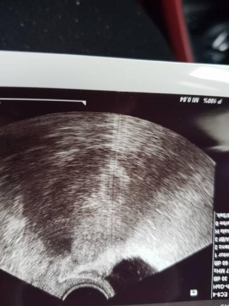 Bild zu 1.Frauenarzt Termin - Forum für Mai - Mamis