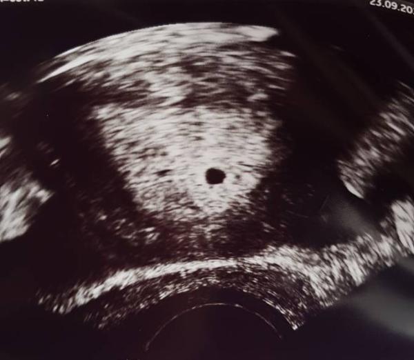 Bild zu 1. Ultraschall - Forum für Mai - Mamis