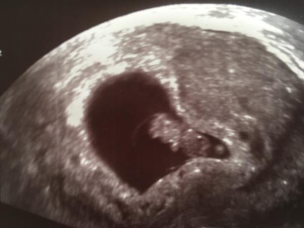 Bild zu 1. US - 8+2 (9. SSW) - Forum für Mai - Mamis