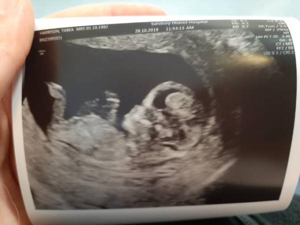Bild zu Es ist tatsächlich ein Baby drin! - Forum für Mai - Mamis