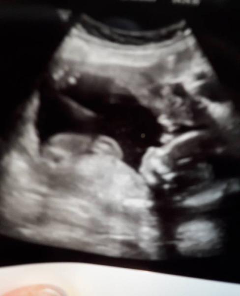 Bild zu enttäuscht... - Forum für Mai - Mamis