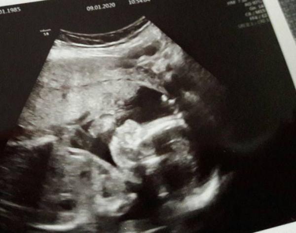 Bild zu 2. Organscreening und definitiv Frauenarztwechsel - Forum für Mai - Mamis