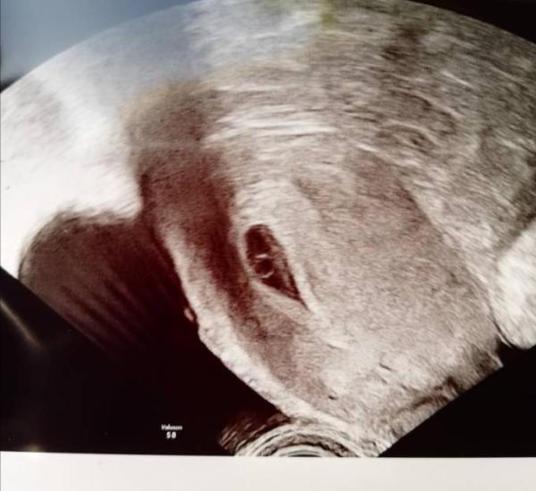 Bild zu 1. Ultraschall - Forum für Mai - Mamis