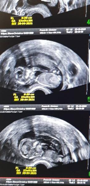 Bild zu Mit einem lachenden und weinenden Auge - Forum für Mai - Mamis
