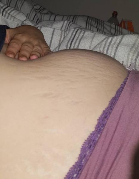 Bild zu Baby oder Blase streicheln - Forum für Mai - Mamis