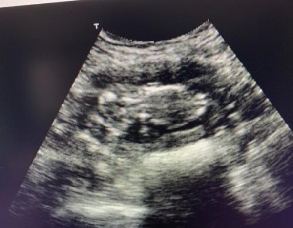 Bild zu Baby us 14 ssw - Forum für Mai - Mamis