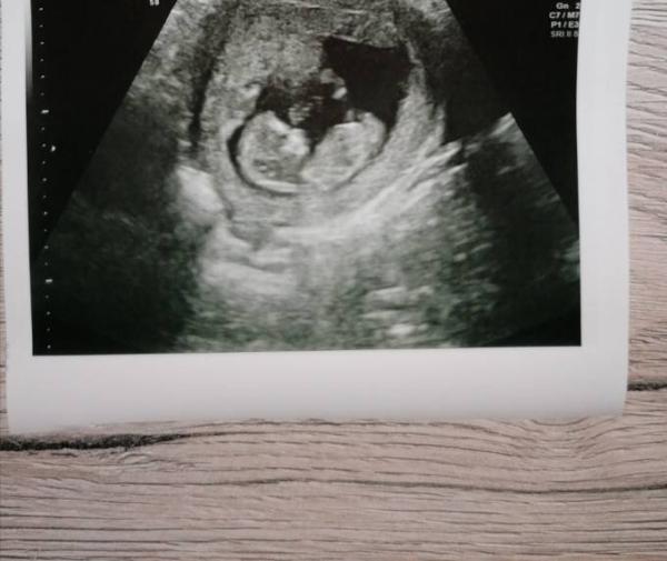 Bild zu FA-Termin❤️ - Forum für Mai - Mamis