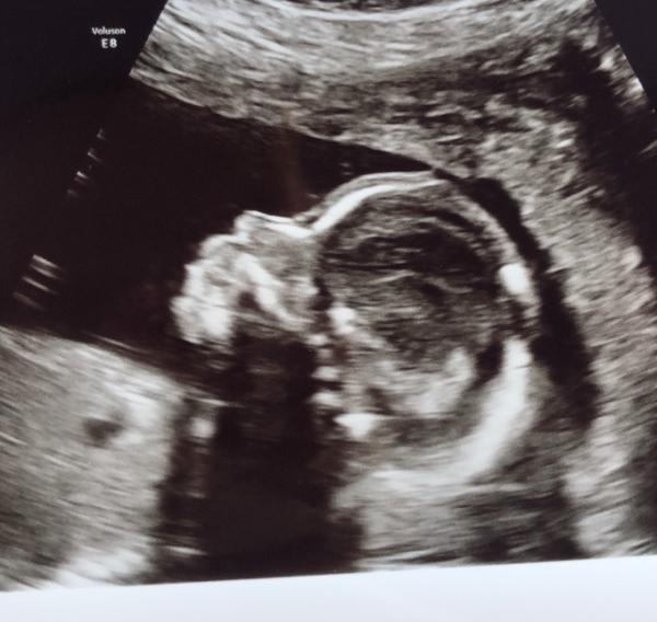 Bild zu Organscreening Größe und Gewicht ☺️ - Forum für Mai - Mamis