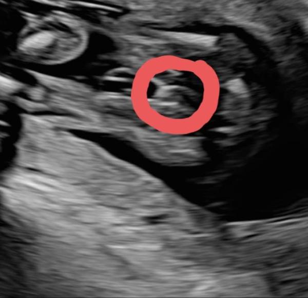 Bild zu Nach was sieht es für euch aus? - Forum für Mai - Mamis