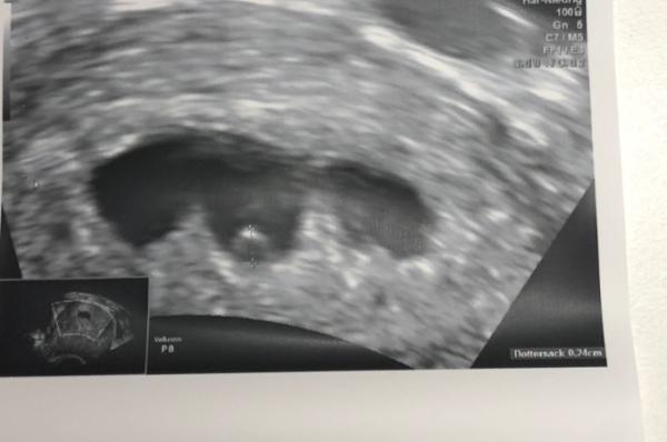 Bild zu @ Schmoni94 Kontrolltermin heute bei 5+6 - Forum für Mai - Mamis
