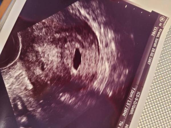 Bild zu Seht ihr was Mädels? US 5+3 - Forum für Mai - Mamis