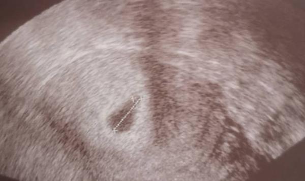 Bild zu Ich steige mit ein! - Forum für Mai - Mamis