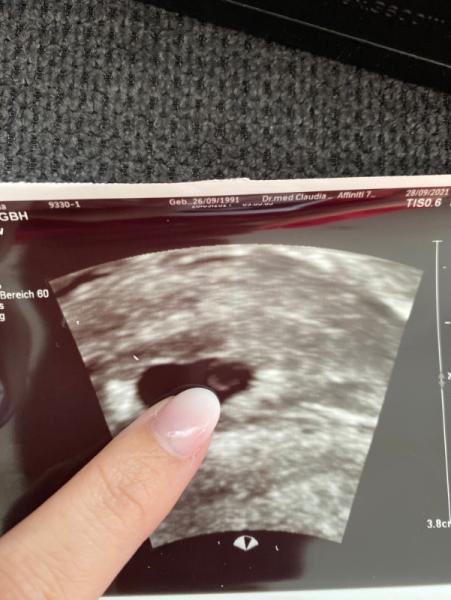 Bild zu Update 6 SSW - Forum für Mai - Mamis