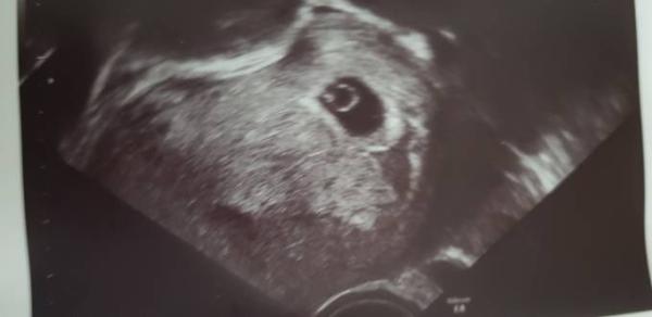 Bild zu Brauche mal eure Meinung - Forum für Mai - Mamis