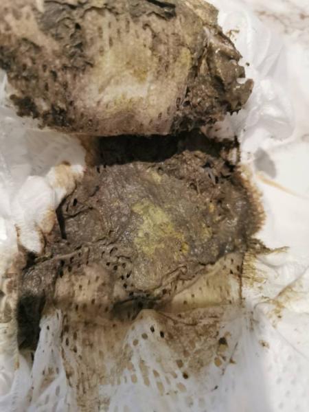 Bild zu Gallenprobleme? Grau-grüner Stuhl? 💩(!! Vorsicht mit Bild!!) - Forum für Mai - Mamis