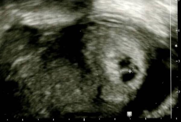 Bild zu Ängste und Sorgen Frühschwangerschaft - Forum für Mai - Mamis