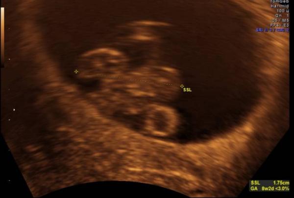 Bild zu Der erste FA Termin 😍 - Forum für Mai - Mamis