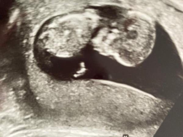 Bild zu Wie verkündet ihr eure Schwangerschaft - Forum für Mai - Mamis