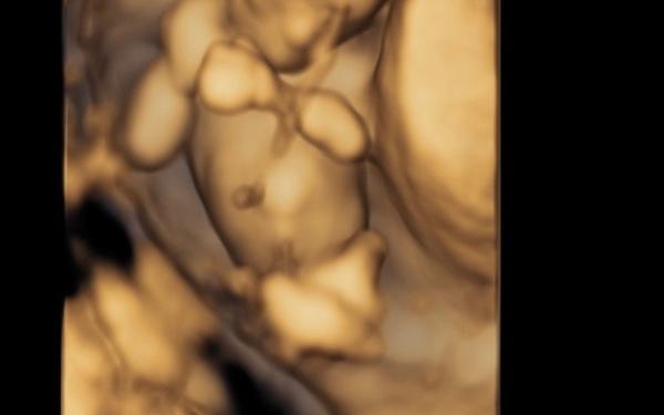 Bild zu 13.SSW Geschlecht - Forum für Mai - Mamis