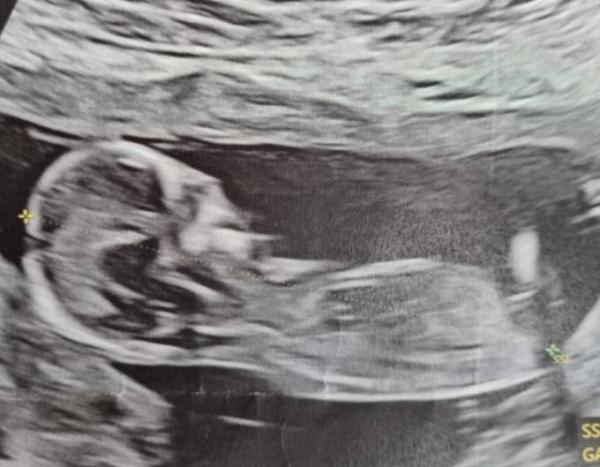 Bild zu Geschlecht - Forum für Mai - Mamis