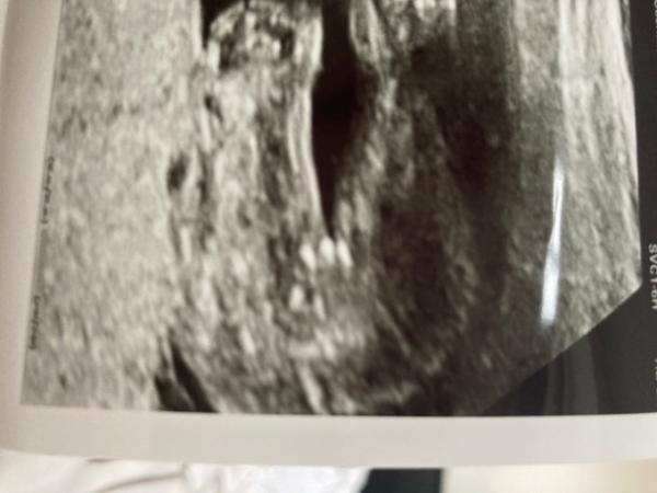 Bild zu Geschlecht!?? - Forum für Mai - Mamis