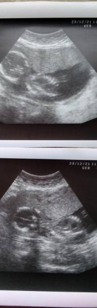 Bild zu Baby hat sich gestern nicht gezeigt - Forum für Mai - Mamis