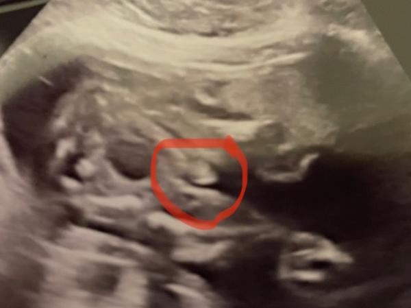 Bild zu Dickbauchdienstag ☺️ - Forum für Mai - Mamis