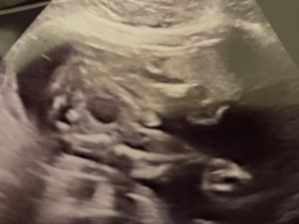 Bild zu Komisches Loch auf dem Foto - Forum für Mai - Mamis