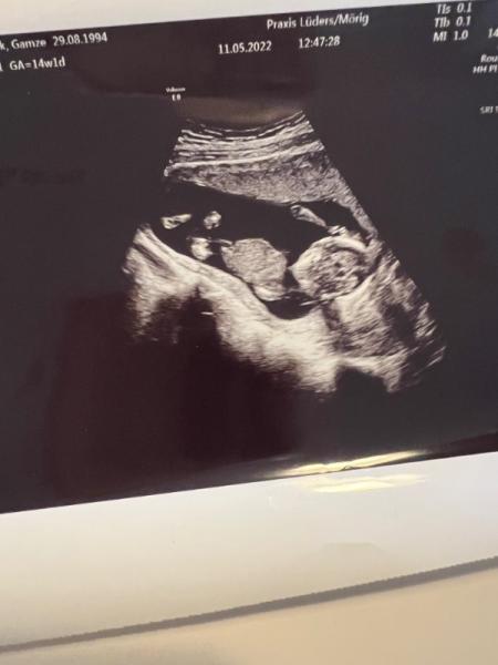 Bild zu Ultraschall Bild - Forum für Mai - Mamis