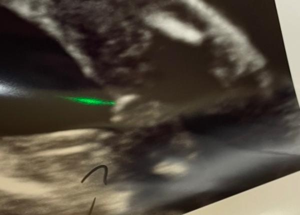 Bild zu Geschlecht Ultraschall - Forum für Mai - Mamis
