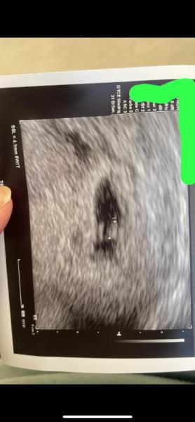 Bild zu Können es 2 sein ? - Forum für Mai - Mamis